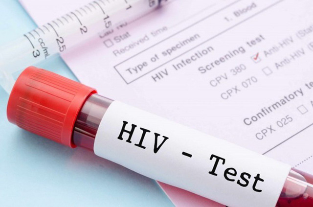 Xét nghiệm số lượng virus HIV chẩn đoán bệnh gì? và hướng dẫn đọc kết quả